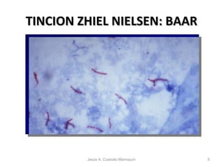 TINCION ZHIEL NIELSEN: BAAR Jesús A. Custodio Marroquín 