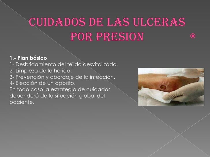 Tratamiento ulceras por presion Tratamiento ulceras por presion