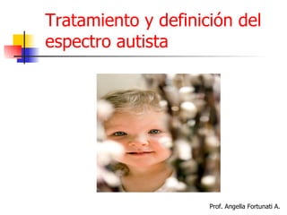 Tratamiento y definición del espectro autista Prof. Angella Fortunati A. 