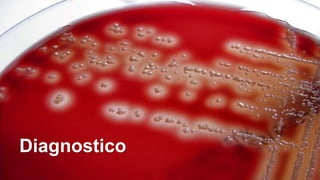 Surviving Sepsis Campaign: International Guidelines for
Management of Sepsis and Septic Shock: 2016 Intensive Care
Med (2017) 43:304–377
Diagnostico
 