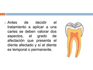  Antes de decidir el
tratamiento a aplicar a una
caries se deben valorar dos
aspectos, el grado de
afectación que presenta el
diente afectado y sí el diente
es temporal o permanente.
 