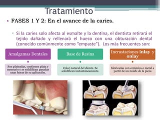 Tratamiento
• FASES 1 Y 2: En el avance de la caries.
▫ Si la caries solo afecta al esmalte y la dentina, el dentista retirará el
tejido dañado y rellenará el hueco con una obturación dental
(conocido comúnmente como “empaste”). Los más frecuentes son:
Amalgamas Dentales
Son plateadas, contienen plata y
mercurio y se solidifican pasadas
unas horas de su aplicación.
Base de Resina
Color natural del diente. Se
solidifican instantáneamente.
Incrustaciones inlay y
onlay
fabricadas con cerámica o metal a
partir de un molde de la pieza
 