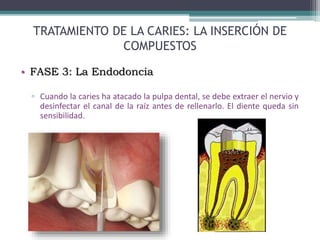 TRATAMIENTO DE LA CARIES: LA INSERCIÓN DE
COMPUESTOS
• FASE 3: La Endodoncia
▫ Cuando la caries ha atacado la pulpa dental, se debe extraer el nervio y
desinfectar el canal de la raíz antes de rellenarlo. El diente queda sin
sensibilidad.
 