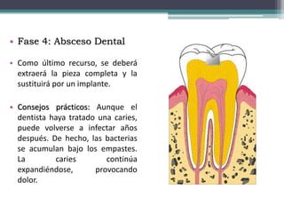 • Fase 4: Absceso Dental
• Como último recurso, se deberá
extraerá la pieza completa y la
sustituirá por un implante.
• Consejos prácticos: Aunque el
dentista haya tratado una caries,
puede volverse a infectar años
después. De hecho, las bacterias
se acumulan bajo los empastes.
La caries continúa
expandiéndose, provocando
dolor.
 