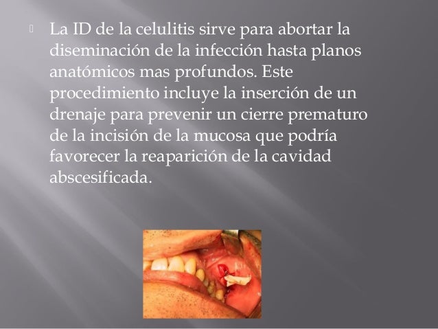 Tratamiento y prevención de las infecciones odontogénicas (2) Tratamiento y prevención de las infecciones odontogénicas (2)