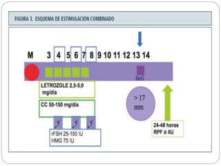 Tratamiento de anovulacion