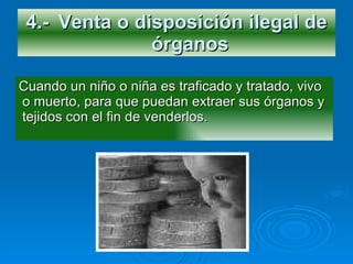4.- Venta o disposición ilegal de órganos   Cuando un niño o niña es traficado y tratado, vivo o muerto, para que puedan extraer sus órganos y tejidos con el fin de venderlos. 