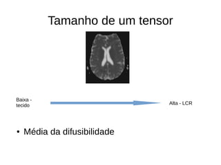 Tamanho de um tensor
● Média da difusibilidade
Baixa -
tecido Alta - LCR
 