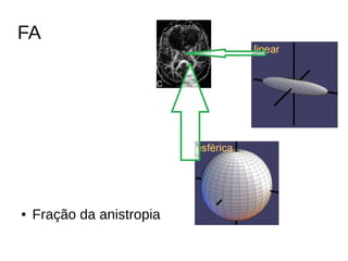 FA
● Fração da anistropia
 