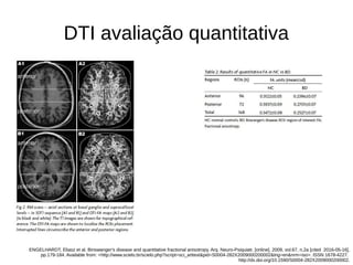 DTI avaliação quantitativa
ENGELHARDT, Eliasz et al. Binswanger's disease and quantitative fractional anisotropy. Arq. Neuro-Psiquiatr. [online]. 2009, vol.67, n.2a [cited 2016-05-16],
pp.179-184. Available from: <http://www.scielo.br/scielo.php?script=sci_arttext&pid=S0004-282X2009000200002&lng=en&nrm=iso>. ISSN 1678-4227.
http://dx.doi.org/10.1590/S0004-282X2009000200002.
 