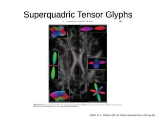 Superquadric Tensor Glyphs
JONES, D. K.; Diffusion MRI. UK: Oxford University Press, 2010, pg 369
 