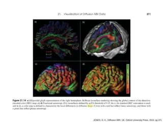 JONES, D. K.; Diffusion MRI. UK: Oxford University Press, 2010, pg 371
 