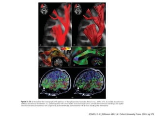 JONES, D. K.; Diffusion MRI. UK: Oxford University Press, 2010, pg 373
 