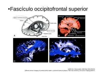 ●Fascículo occipitofrontal superior
AJNR Am J Neuroradiol. 2004 Mar;25(3):356-69.
Diffusion tensor imaging of cerebral white matter: a pictorial review of physics, fiber tract anatomy, and tumor imaging patterns.
 