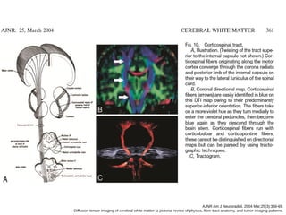 AJNR Am J Neuroradiol. 2004 Mar;25(3):356-69.
Diffusion tensor imaging of cerebral white matter: a pictorial review of physics, fiber tract anatomy, and tumor imaging patterns.
 