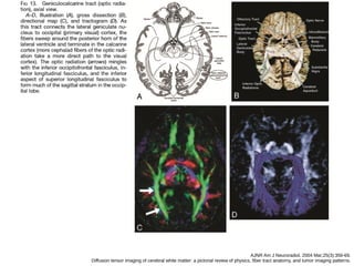 AJNR Am J Neuroradiol. 2004 Mar;25(3):356-69.
Diffusion tensor imaging of cerebral white matter: a pictorial review of physics, fiber tract anatomy, and tumor imaging patterns.
 