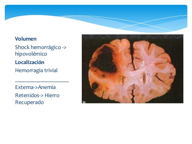 Trastornos hemodinámicos, enfermedad tromboembólica y shock