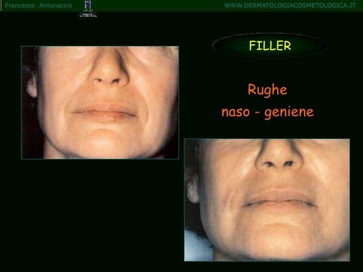 Get Rughe geniene HD