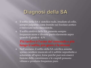 Diagnosi della SAIl soffio della SA è  sistolico rude, irradiato al collo, sempre palpabile come fremito sul focolaio aortico e rinforzato nella mesosistole.Il soffio eiettivo della SA presenta sempre frequenze miste e diventa particolarmente aspro quando il grado è  4/6. Più tardivo è l'acme del crescendo e più lungo il soffio, più grave è la stenosi Nell'anziano, il soffio della SA calcifica assume spesso carattere musicale ed è udibile soprattutto o solamente all'apice, forse perché può non esserci fusione delle commissure e le cuspidi possono vibrare e produrre frequenze pure.