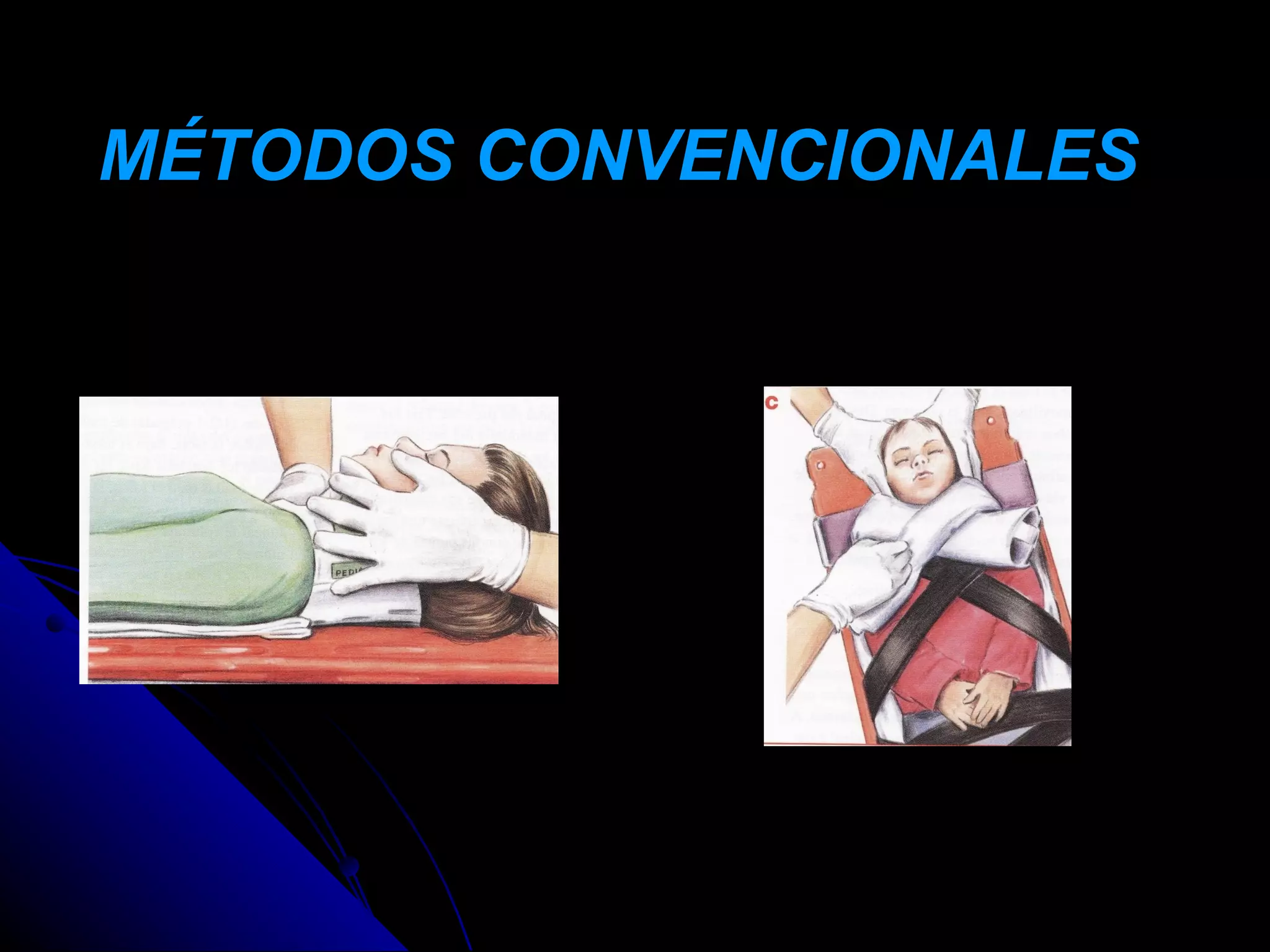 MÉTODOS CONVENCIONALES
 