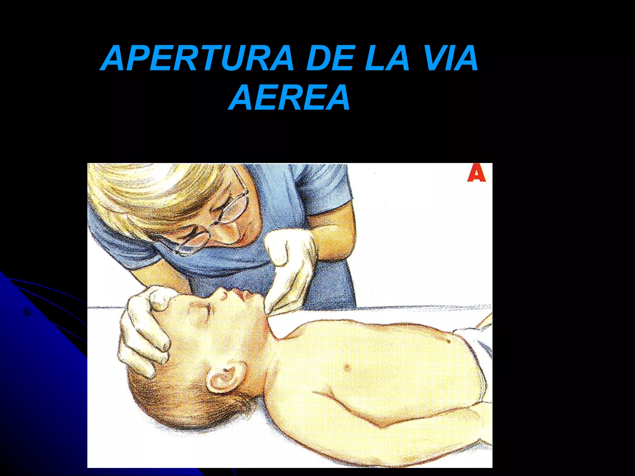 APERTURA DE LA VIA
     AEREA
 