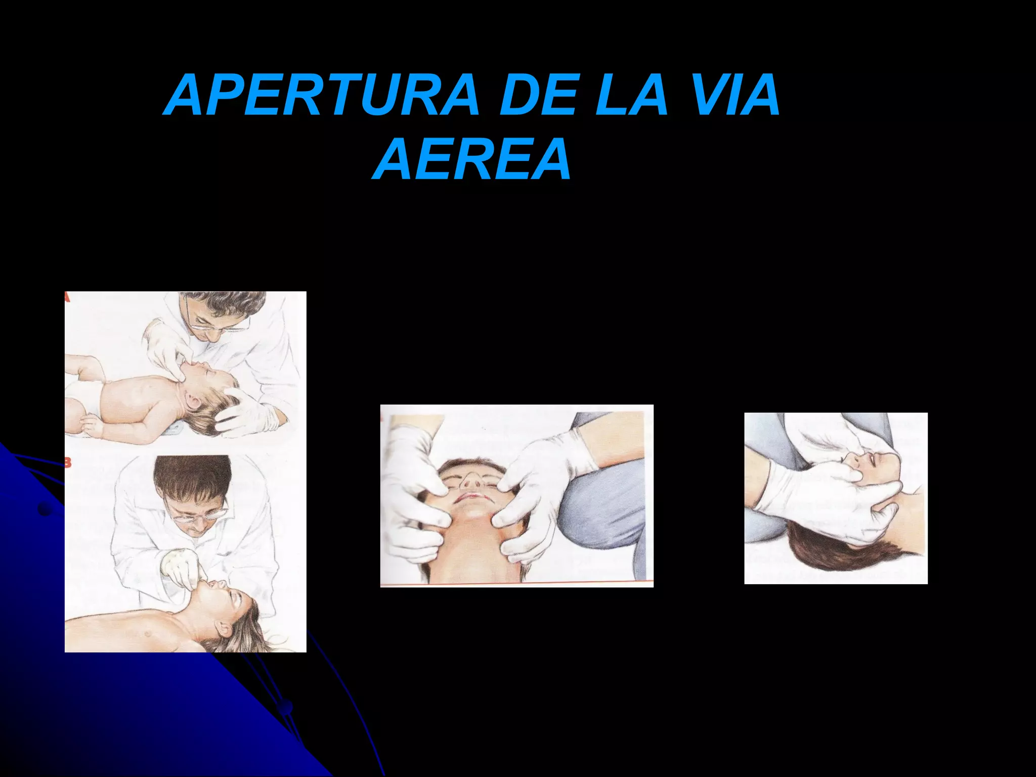 APERTURA DE LA VIA
     AEREA
 