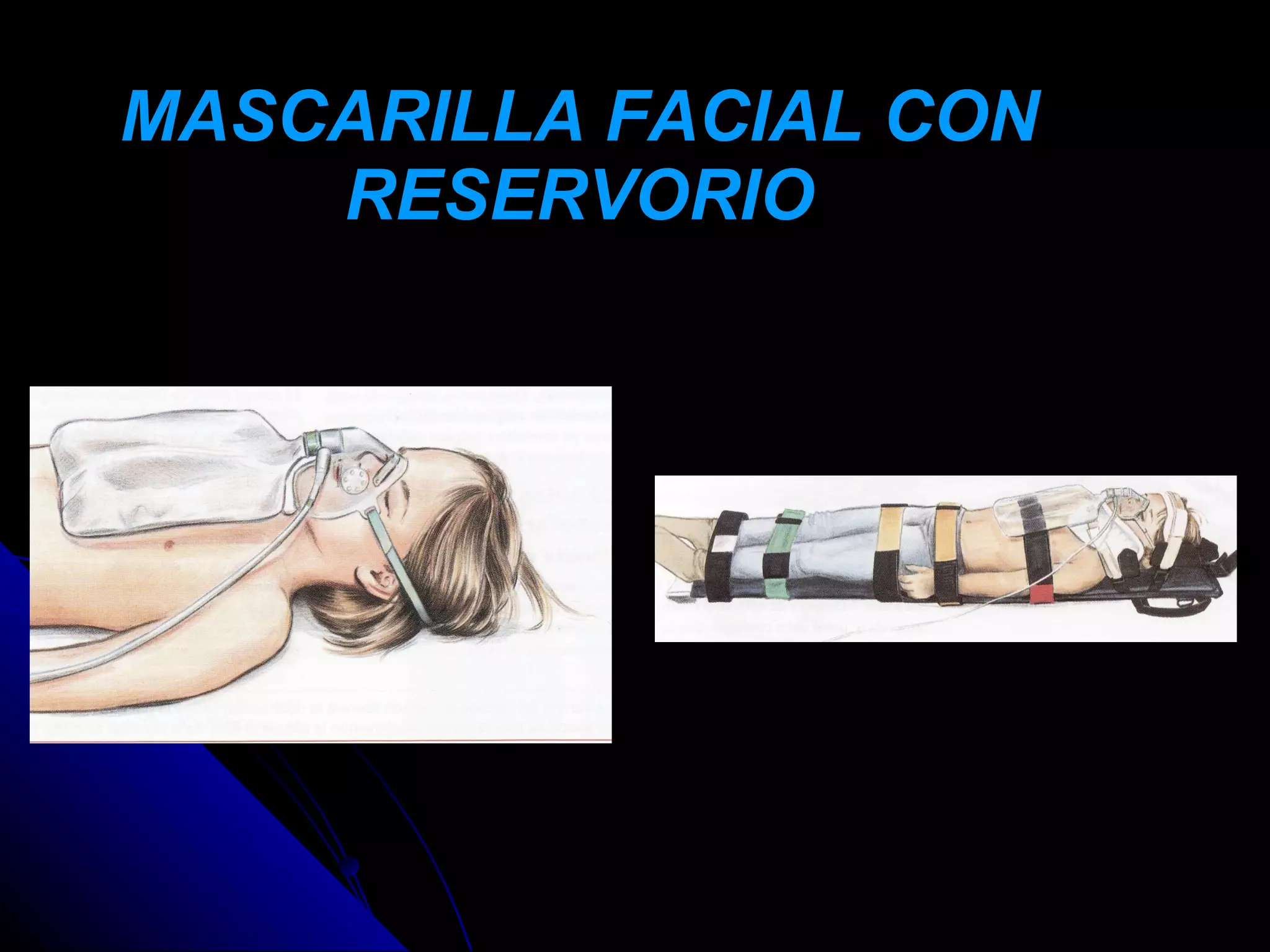 MASCARILLA FACIAL CON
    RESERVORIO
 