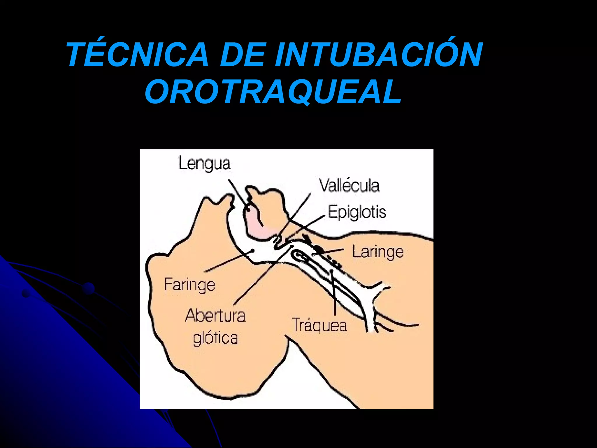 TÉCNICA DE INTUBACIÓN
    OROTRAQUEAL
 
