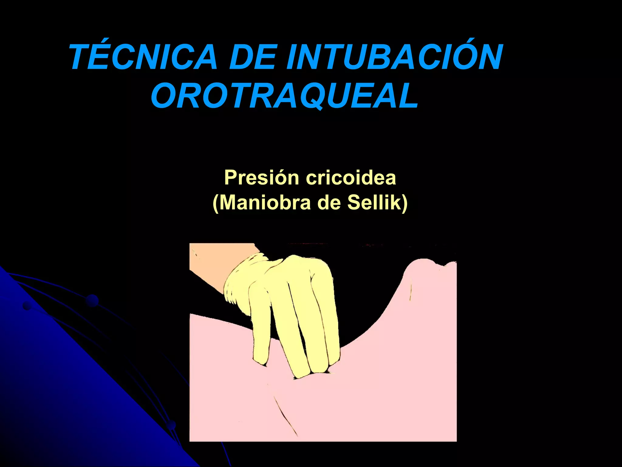 TÉCNICA DE INTUBACIÓN
    OROTRAQUEAL

        Presión cricoidea
       (Maniobra de Sellik)
 