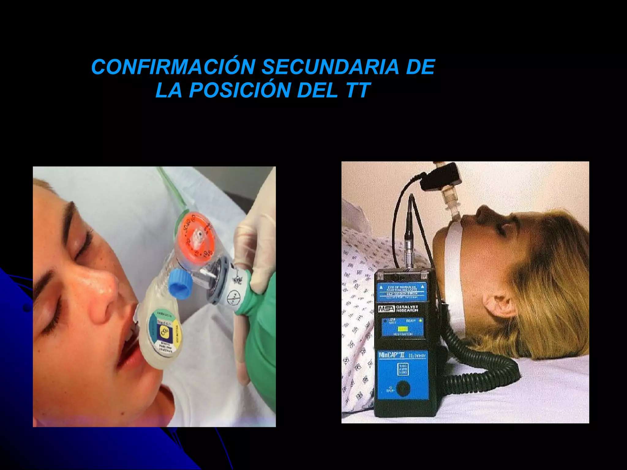 CONFIRMACIÓN SECUNDARIA DE
     LA POSICIÓN DEL TT
 