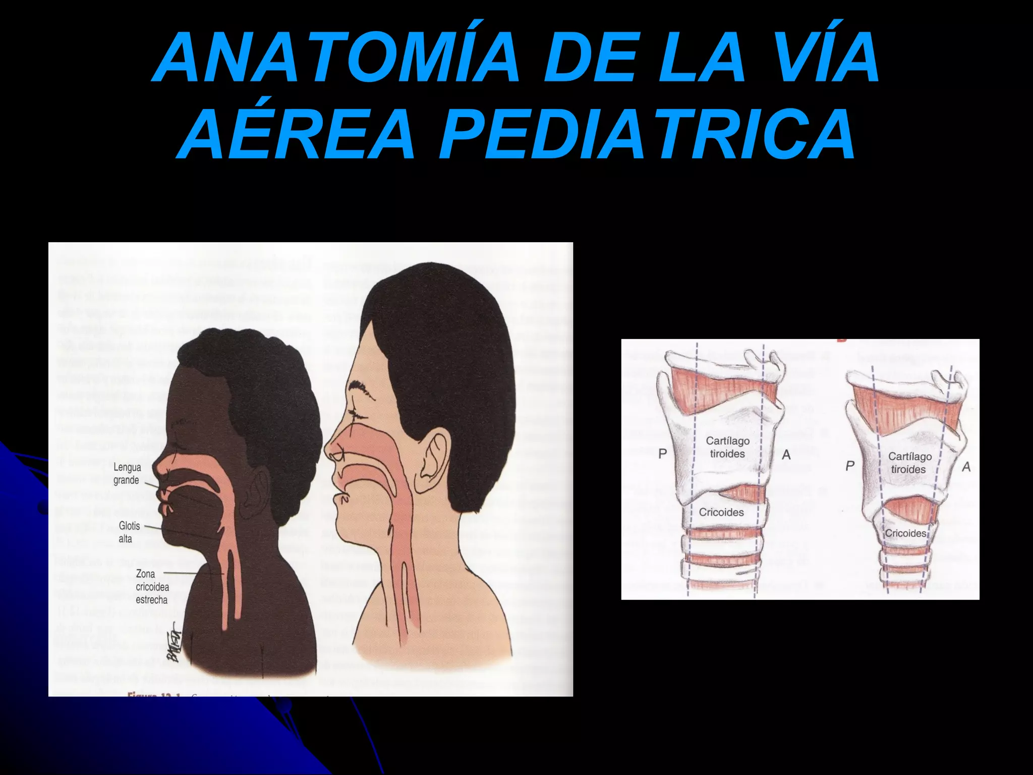 ANATOMÍA DE LA VÍA
AÉREA PEDIATRICA
 