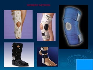 MIEMBRO INFERIOR.