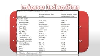 • ACOG recomendaciones para estudios
  imágenes.
• Hasta 5 rad o 50 mGy de exposición no se
  asocia a aumento de muertes fetales o
  Malformaciones
• Sin protección la radiación fetal es 30% de
  la Materna
 