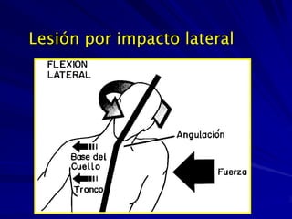 Lesión por impacto lateral
 