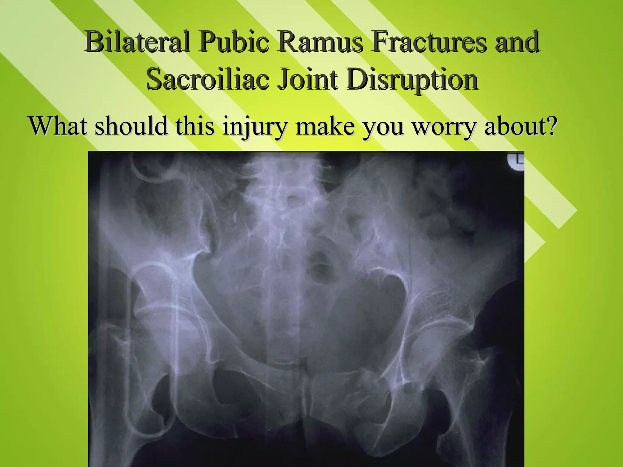 Trauma | PPT