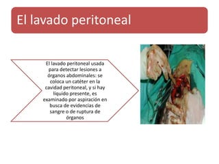 El lavado peritoneal
El lavado peritoneal usada
para detectar lesiones a
órganos abdominales: se
coloca un catéter en la
cavidad peritoneal, y si hay
líquido presente, es
examinado por aspiración en
busca de evidencias de
sangre o de ruptura de
órganos
 