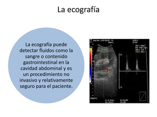 La ecografía
La ecografía puede
detectar fluidos como la
sangre o contenido
gastrointestinal en la
cavidad abdominal y es
un procedimiento no
invasivo y relativamente
seguro para el paciente.
 