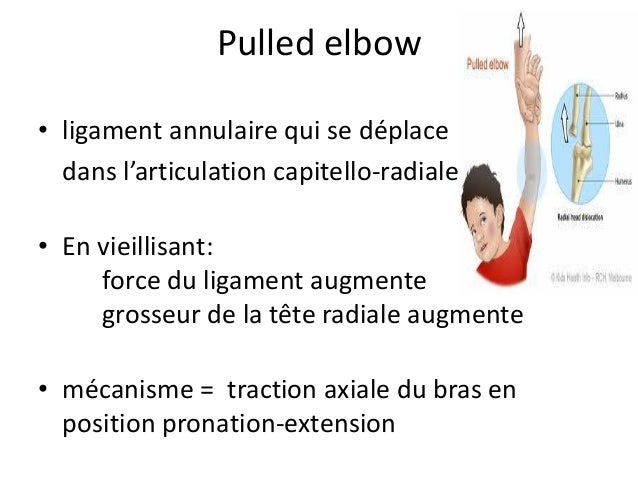 Les moyens nationaux de laugmentation le membre