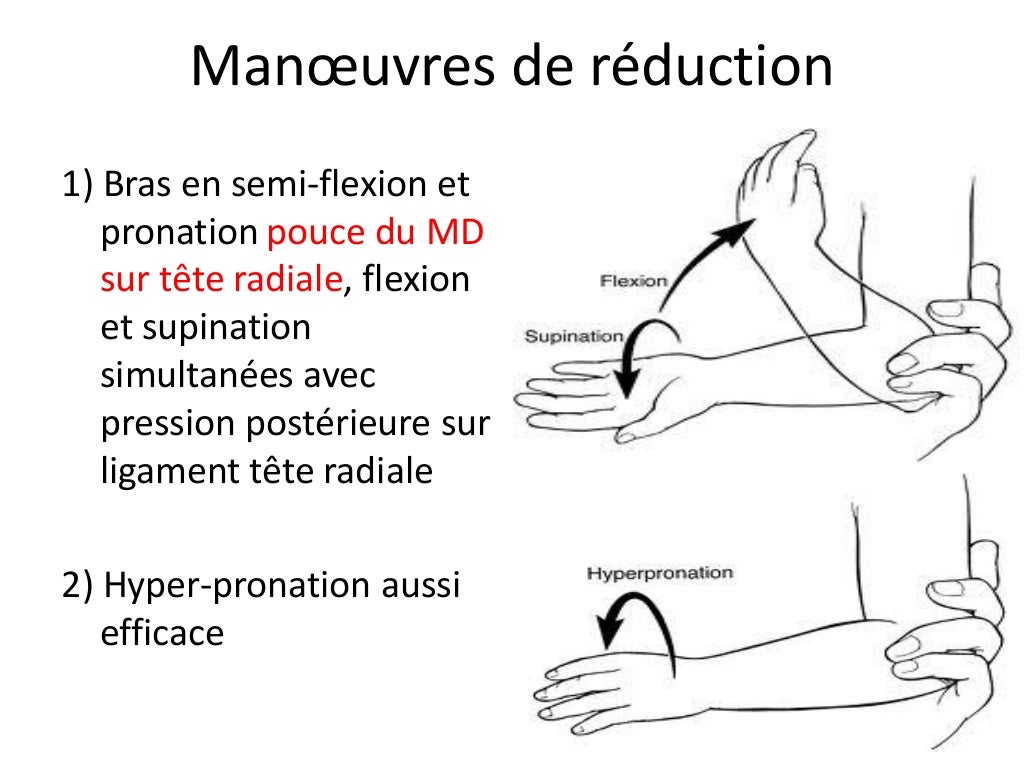 Traumas du membre supérieur en pédiatrie Traumas du membre supérieur en pédiatrie