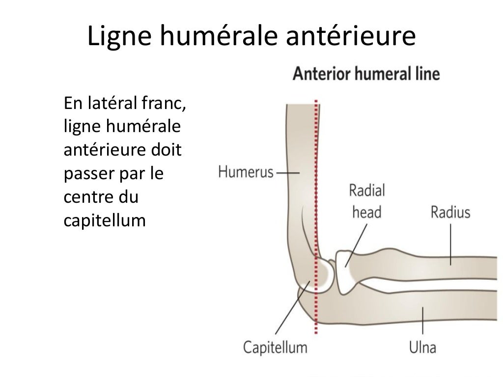 Traumas du membre supérieur en pédiatrie Traumas du membre supérieur en pédiatrie