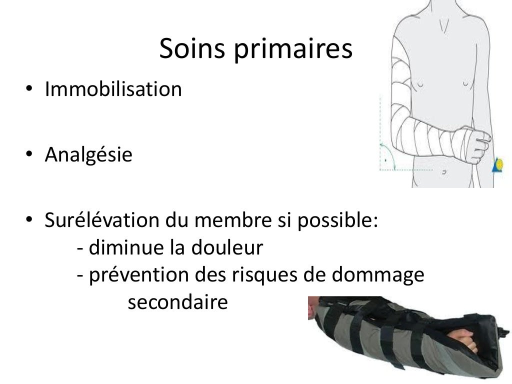 Traumas du membre supérieur en pédiatrie Traumas du membre supérieur en pédiatrie