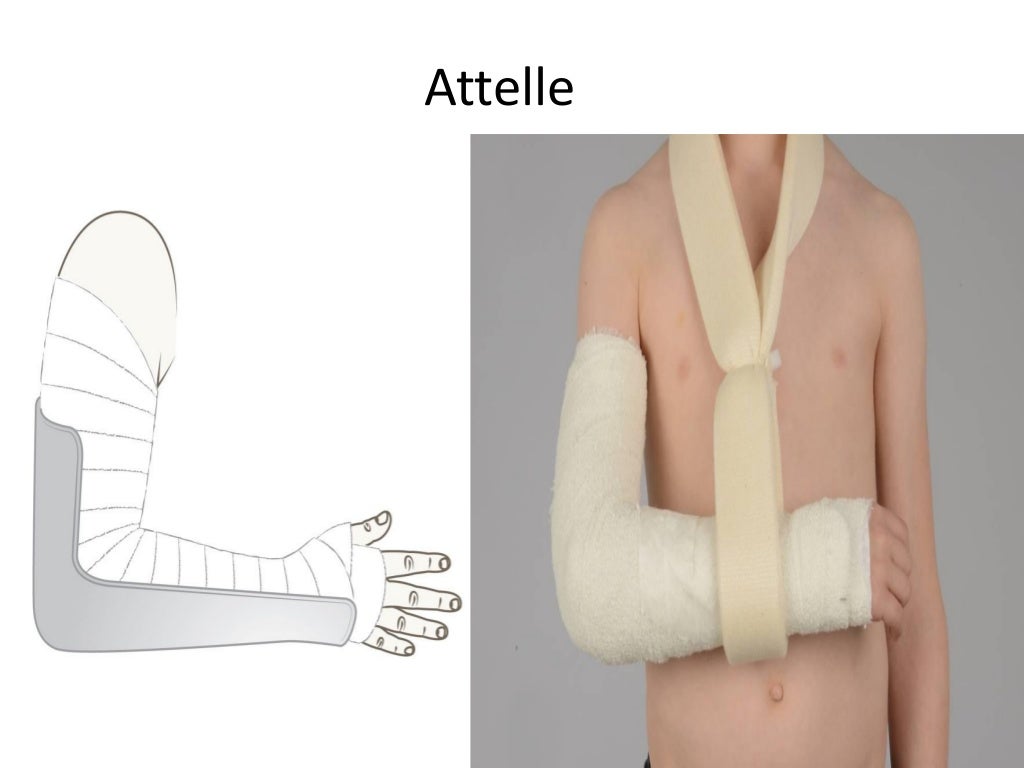 Traumas du membre supérieur en pédiatrie Traumas du membre supérieur en pédiatrie