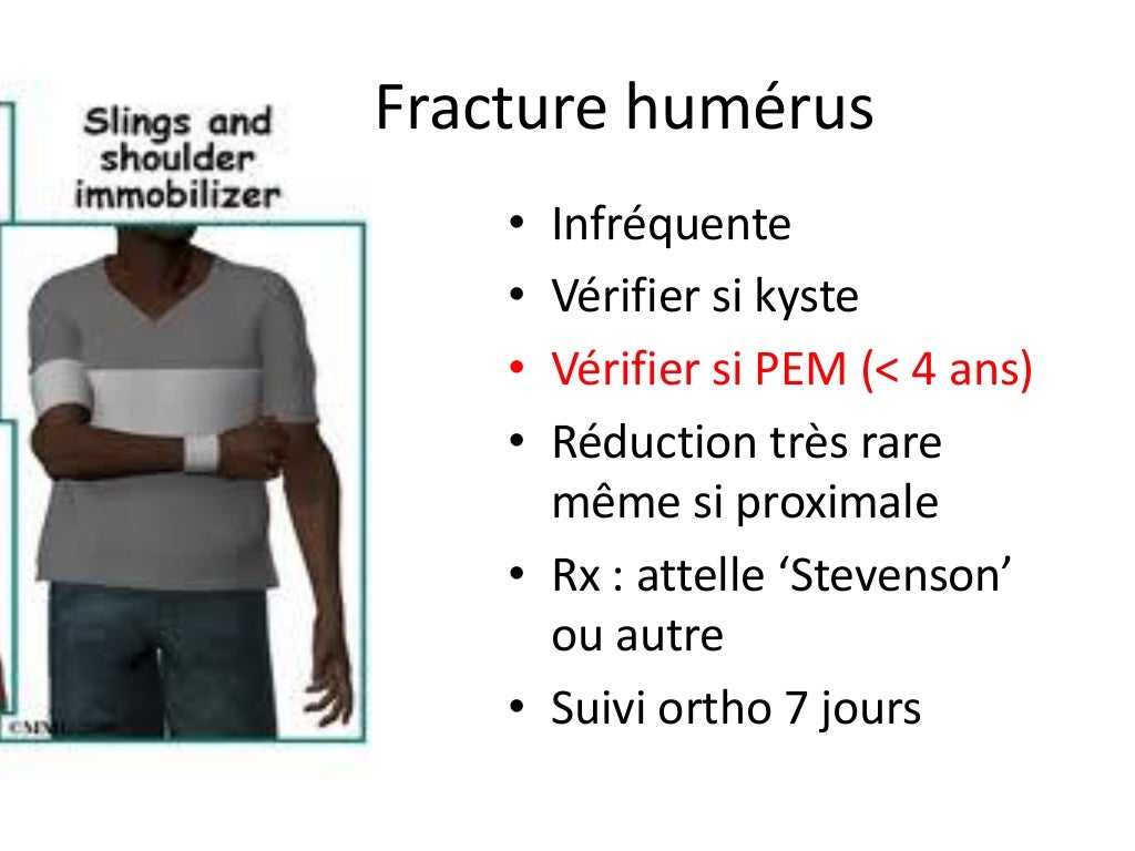 Traumas du membre supérieur en pédiatrie Traumas du membre supérieur en pédiatrie
