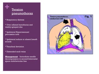 + Tension
pneumothorax
* Respiratory distress
* Over inflated hemithorax and
visibly splayed ribs
* Ipsilateral Hyperresonant
percussion note
* Ipsilateral reduce or absent breath
sounds
* Treacheal deviation
* Distended neck veins
Management: Immediate needle
decompression in second Intercostal
space midclavicular line

 
