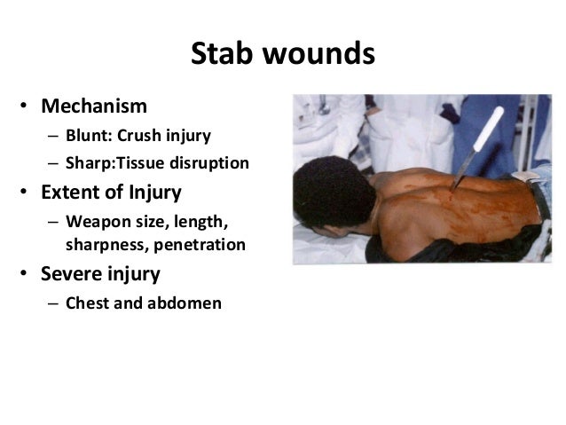 stab wound stab wound