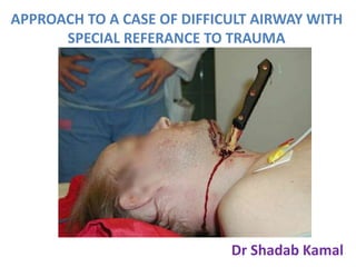 APPROACH TO A CASE OF DIFFICULT AIRWAY WITH
SPECIAL REFERANCE TO TRAUMA
Dr Shadab Kamal
 