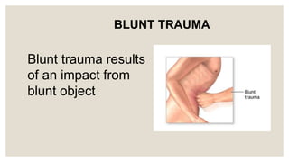 Trauma Nursing | PPTX