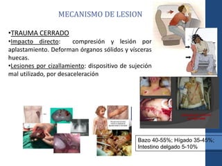 MECANISMO DE LESION
•TRAUMA CERRADO
•Impacto directo: compresión y lesión por
aplastamiento. Deforman órganos sólidos y vísceras
huecas.
•Lesiones por cizallamiento: dispositivo de sujeción
mal utilizado, por desaceleración
Bazo 40-55%; Hígado 35-45%;
Intestino delgado 5-10%