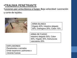 •TRAUMA PENETRANTE
•Lesiones por arma blanca o fuego: Baja velocidad: Laceración
y corte de tejidos.
ARMA DE FUEGO
Intestino delgado 50%; Colon
40%; Hígado 30%; Estructuras
vasculares 25%
ARMA BLANCA
Hígado 40%; Intestino delgado
30%; Diafragma 20%; Colon 15%
EXPLOSIONES
Penetrantes o cerrados
Onda expansiva: pulmones o
vísceras huecas