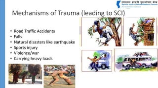 Mechanisms of Trauma (leading to SCI)
• Road Traffic Accidents
• Falls
• Natural disasters like earthquake
• Sports injury
• Violence/war
• Carrying heavy loads
 